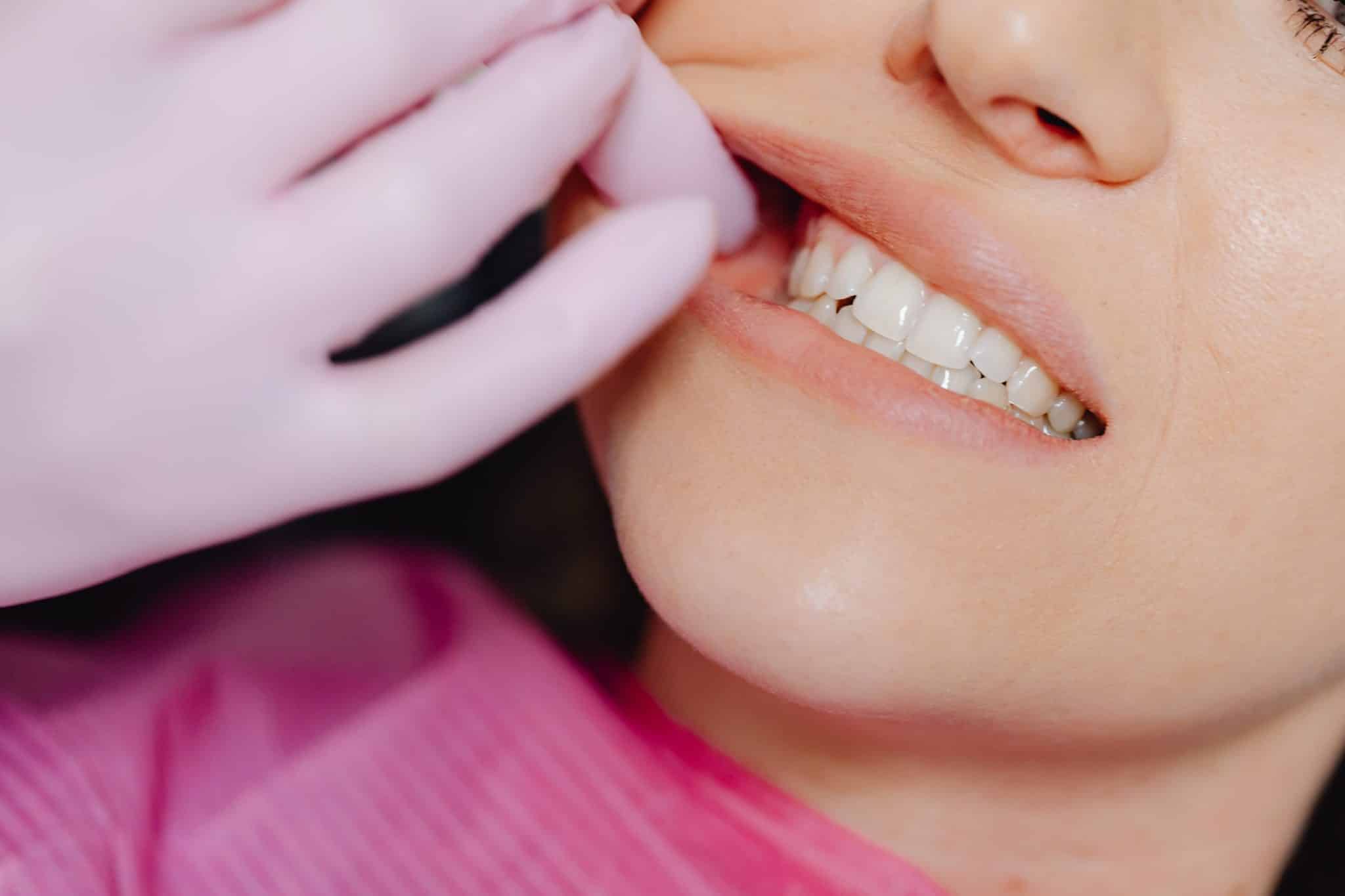 Colletti dentali scoperti: rimedi e trattamento 
