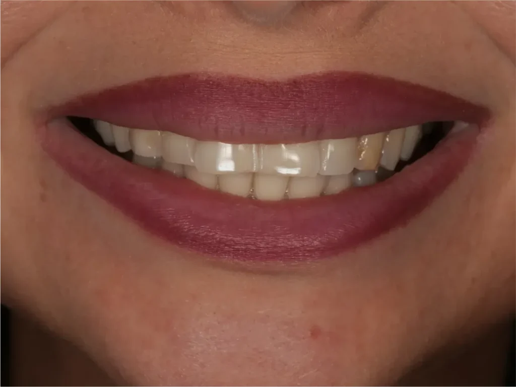 Frame 2147225985