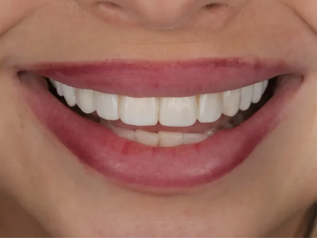 Frame 2147225986