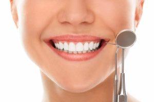 Donna con sorriso che mostra sbiancamento denti