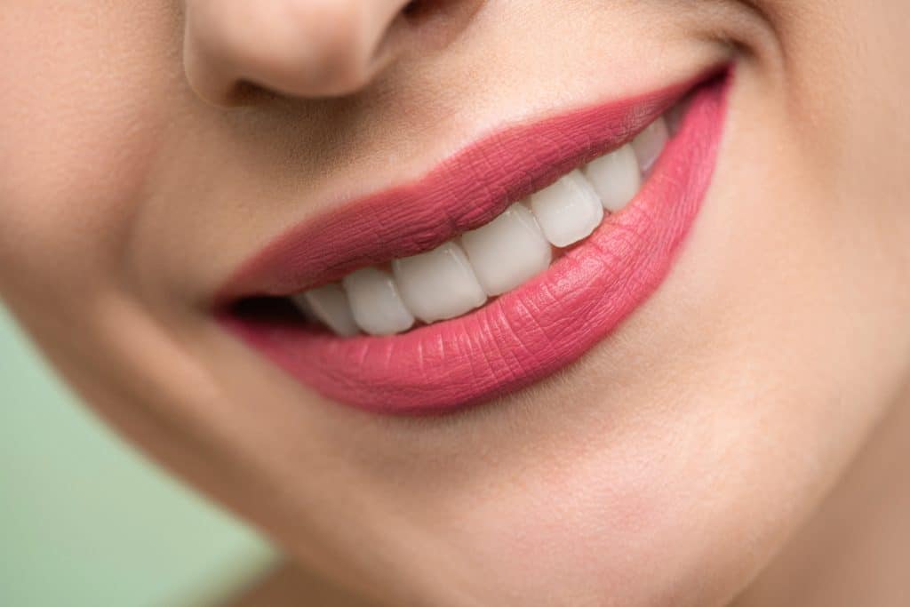 Faccette dentali: tra i trattamenti più richiesti presso il Centro Bellemo, le faccette sono utili per ristabilire estetica e funzionalità del sorriso.