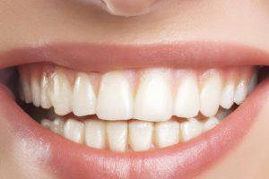 Quando sottoporsi al trattamento di sbiancamento denti? Scoprilo leggendo l'articolo dedicato.