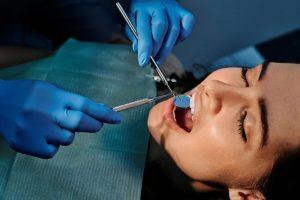 Devitalizzazione dente: scopriamo insieme vantaggi, svantaggi, costi, funzionamento e cura post operatoria di questa procedura.