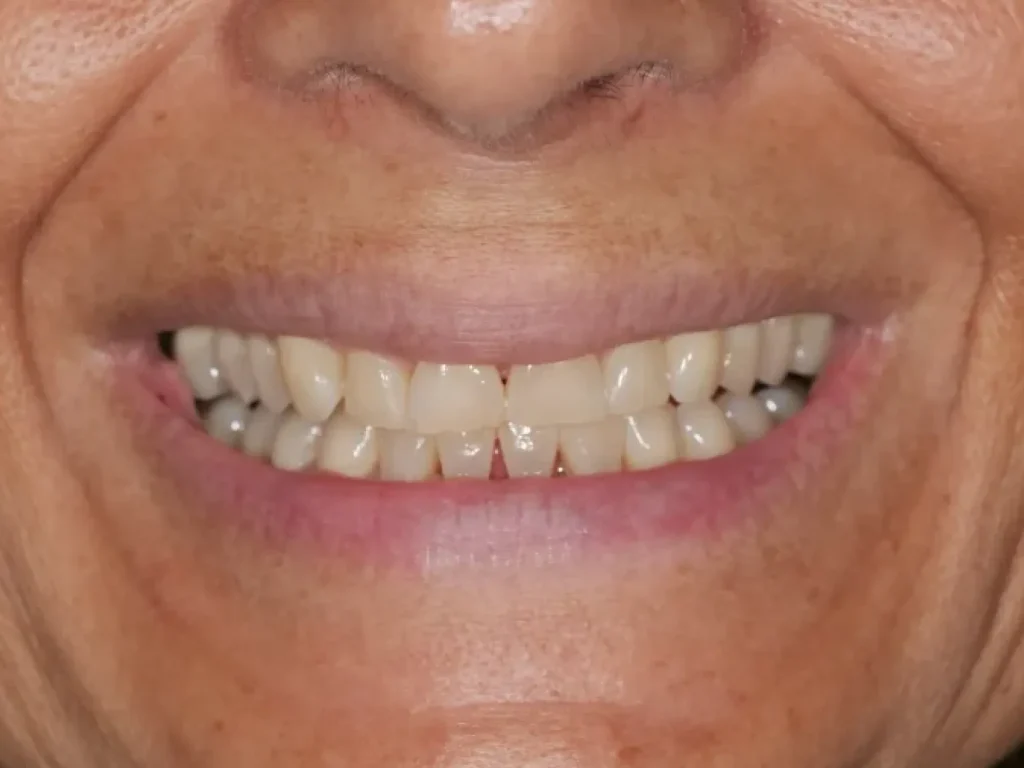 Frame 2147225992 1