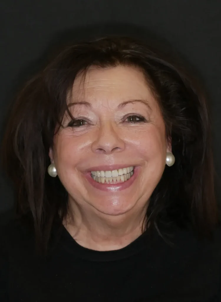 pelosini 2