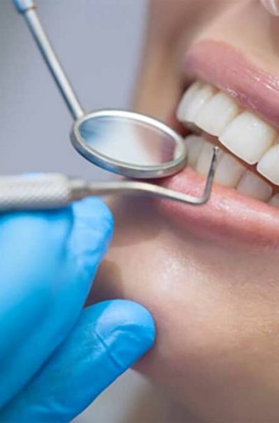 Perché intervenire sui denti naturali? Avere tutte le accortezze necessarie per conservare i propri denti naturali è un'ottima abitudine.